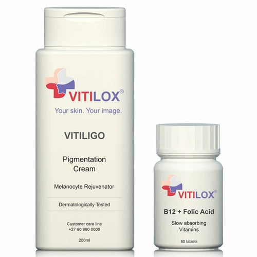 Vitilox Pigmentation Cream + Vitamins - Zencare
