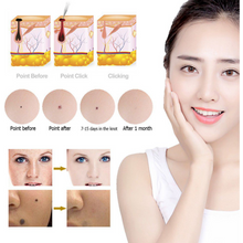 Load image into Gallery viewer, LCD Laser - mole, freckle and Wart remover pen - Zencare
