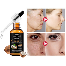 Load image into Gallery viewer, Coconut whitening Serum - Zencare
