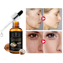 Load image into Gallery viewer, Coconut whitening Serum - Zencare